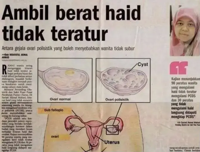 Keratan akhbar berkaitan kesihatan wanita nombor empat